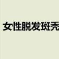 女性脱发斑秃原因及治疗（斑秃原因及治疗）