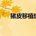 猪皮移植烧伤面属于什么（猪皮移植）