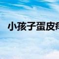 小孩子蛋皮痒怎么回事（蛋皮痒怎么回事）