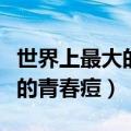 世界上最大的青春痘挤破的过程（世界上最大的青春痘）