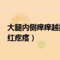 大腿内侧痒痒越抓越痒变黑了（大腿内侧痒痒越抓越痒有小红疙瘩）