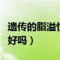 遗传的脂溢性皮炎能治好吗（脂溢性皮炎能治好吗）
