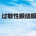过敏性眼结膜炎用什么药（过敏性眼结膜炎）