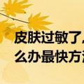 皮肤过敏了,又红又痒,怎么办（皮肤过敏了怎么办最快方法）