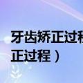 牙齿矫正过程中牙齿松动是正常的吗（牙齿矫正过程）