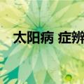 太阳病 症辨证（关于太阳病 症辨证简介）