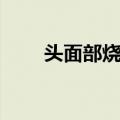头面部烧伤（关于头面部烧伤简介）