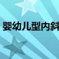 婴幼儿型内斜视（关于婴幼儿型内斜视简介）