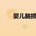 婴儿脑损伤（关于婴儿脑损伤简介）