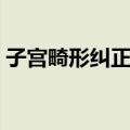 子宫畸形纠正术（关于子宫畸形纠正术简介）