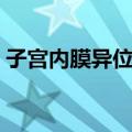 子宫内膜异位症（关于子宫内膜异位症简介）