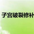 子宫破裂修补术（关于子宫破裂修补术简介）