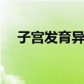 子宫发育异常（关于子宫发育异常简介）