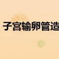 子宫输卵管造影（关于子宫输卵管造影简介）