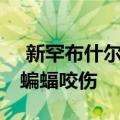  新罕布什尔州男子被藏在iPad案件中的狂热蝙蝠咬伤