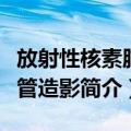 放射性核素脑血管造影（关于放射性核素脑血管造影简介）