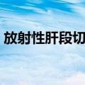 放射性肝段切除（关于放射性肝段切除简介）