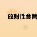 放射性食管炎（关于放射性食管炎简介）