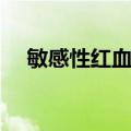 敏感性红血丝（关于敏感性红血丝简介）