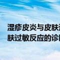 湿疹皮炎与皮肤过敏反应的诊断与治疗（关于湿疹皮炎与皮肤过敏反应的诊断与治疗介绍）