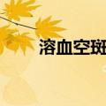 溶血空斑法（关于溶血空斑法介绍）