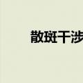 散斑干涉法（关于散斑干涉法简介）