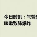 今日时讯：气管里卡骨头致老人反复发热咳嗽 男子长年吸烟咳嗽致肺爆炸