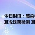 今日时讯：感染者家庭成员或其他密切接触者是否应该接受耳念珠菌检测 耳念珠菌感染可以治疗吗