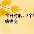 今日时讯：7个部位长痣或是癌症信号 4种情况需要警惕黑痣癌变