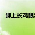 脚上长鸡眼怎么办（6种小妙招帮你解决）