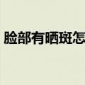 脸部有晒斑怎么去掉（脸上晒斑怎么去掉呢）