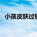 小孩皮肤过敏怎么办（要重视这四个方面）