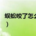 蜈蚣咬了怎么处理方法（被蜈蚣咬伤了怎么办）