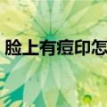 脸上有痘印怎么办（这些办法有效去除痘印）