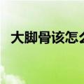 大脚骨该怎么办（四个小方法你掌握了吗）