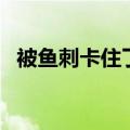 被鱼刺卡住了怎么办（三个错误偏方介绍）