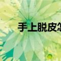 手上脱皮怎么办（把握以下治疗方法）