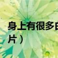 身上有很多白色的小颗粒（冠状沟白色颗粒图片）
