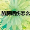 胳膊晒伤怎么办快速消除（胳膊晒伤怎么办）