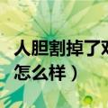 人胆割掉了对人体力有影响吗（人胆切除后会怎么样）