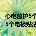 心电监护5个电极贴法 示意图真人（心电监护5个电极贴法）