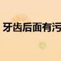 牙齿后面有污垢（牙齿后面的牙垢怎么去除）