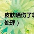 皮肤晒伤了怎么办才能快速恢复（晒伤后怎么处理）