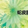 蛇皮腿能不能根治（蛇皮腿）