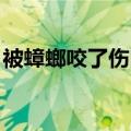 被蟑螂咬了伤口图片图（蟑螂咬人吗 有毒吗）