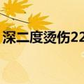 深二度烫伤22天恢复程度（三度烧伤表现为）