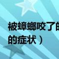 被蟑螂咬了的症状多久后有反应（被蟑螂咬了的症状）