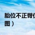 胎位不正臀位朝下怎么办（胎位不正臀位纠正图）