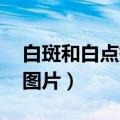 白斑和白点癫风的 图片区别（儿童白色糠疹图片）