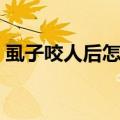 虱子咬人后怎么治疗（虱子咬人后症状图片）